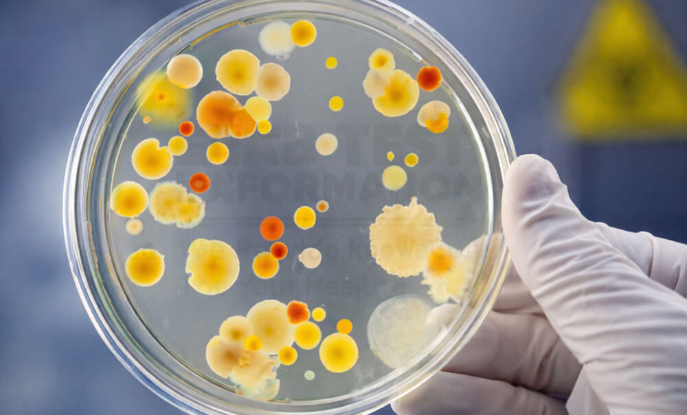 Culture and Sensitivity Testing