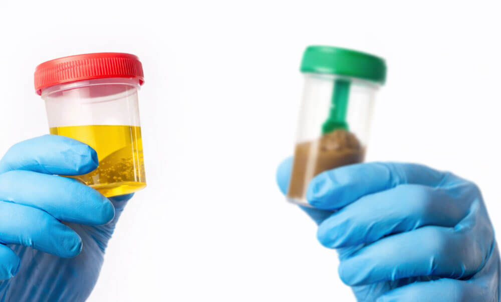 Urine and Stool Testing Services